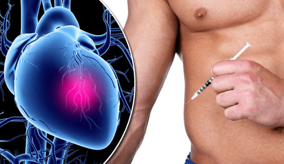 Understanding the Connection Between Anavar and Heart Problems
